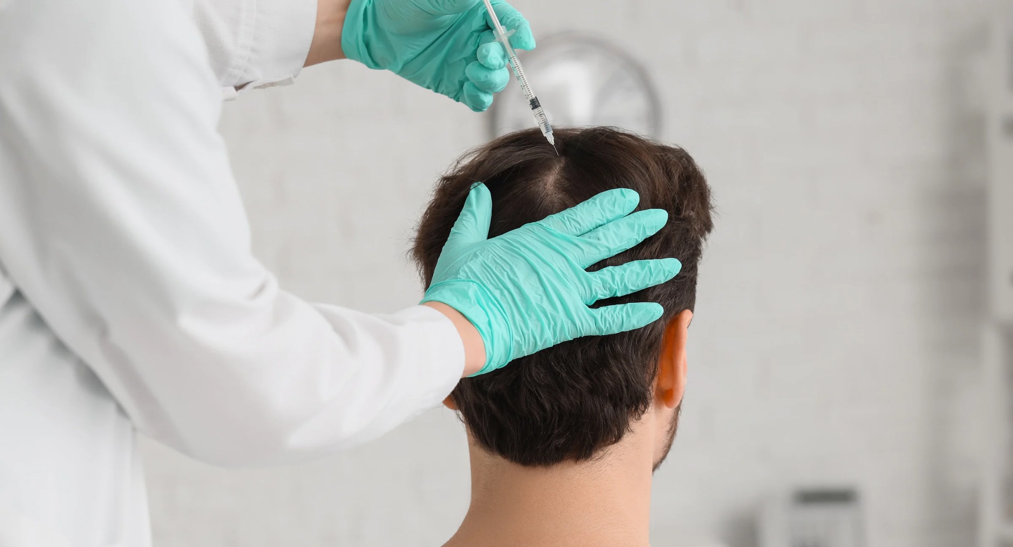 Causas de la caída del cabello