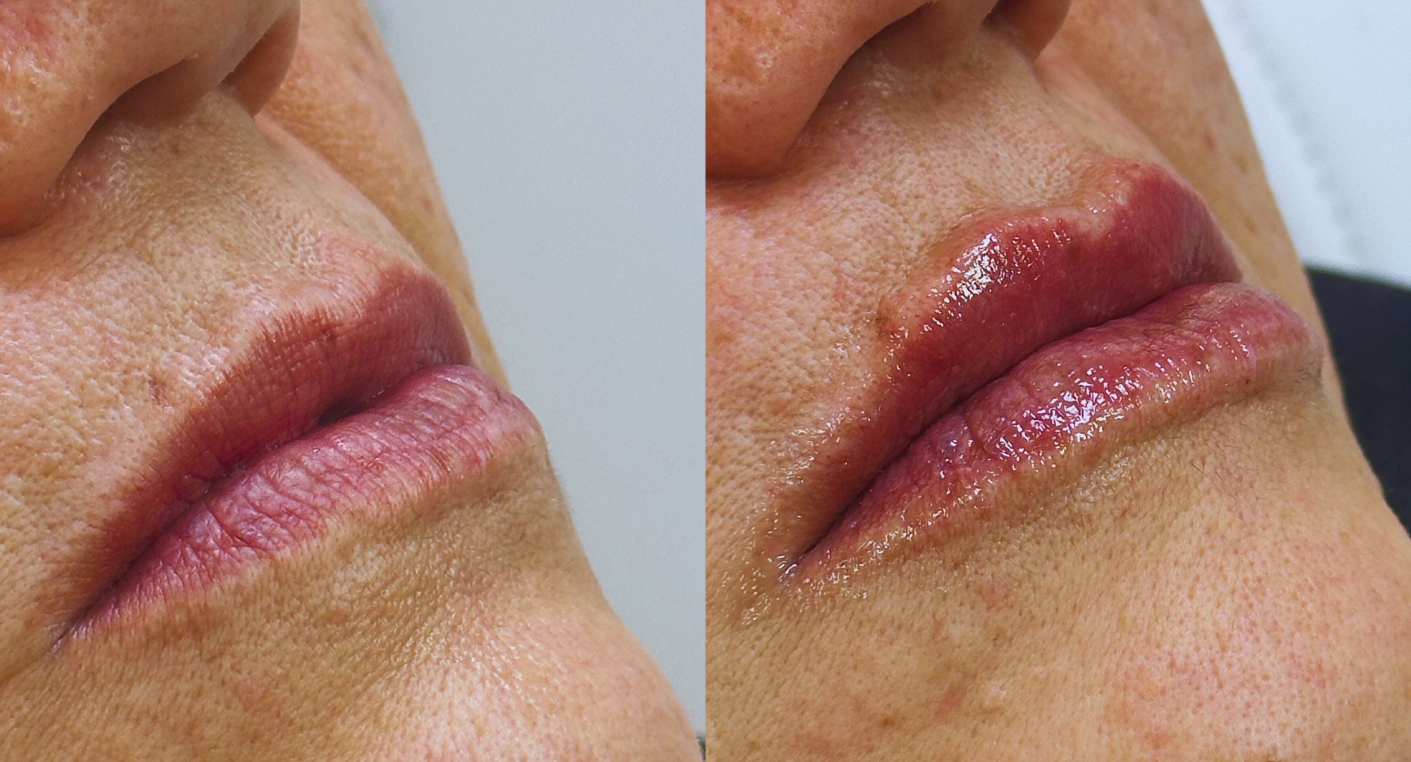 F-PERFECT LIPS - Hidratación Profunda de Labios