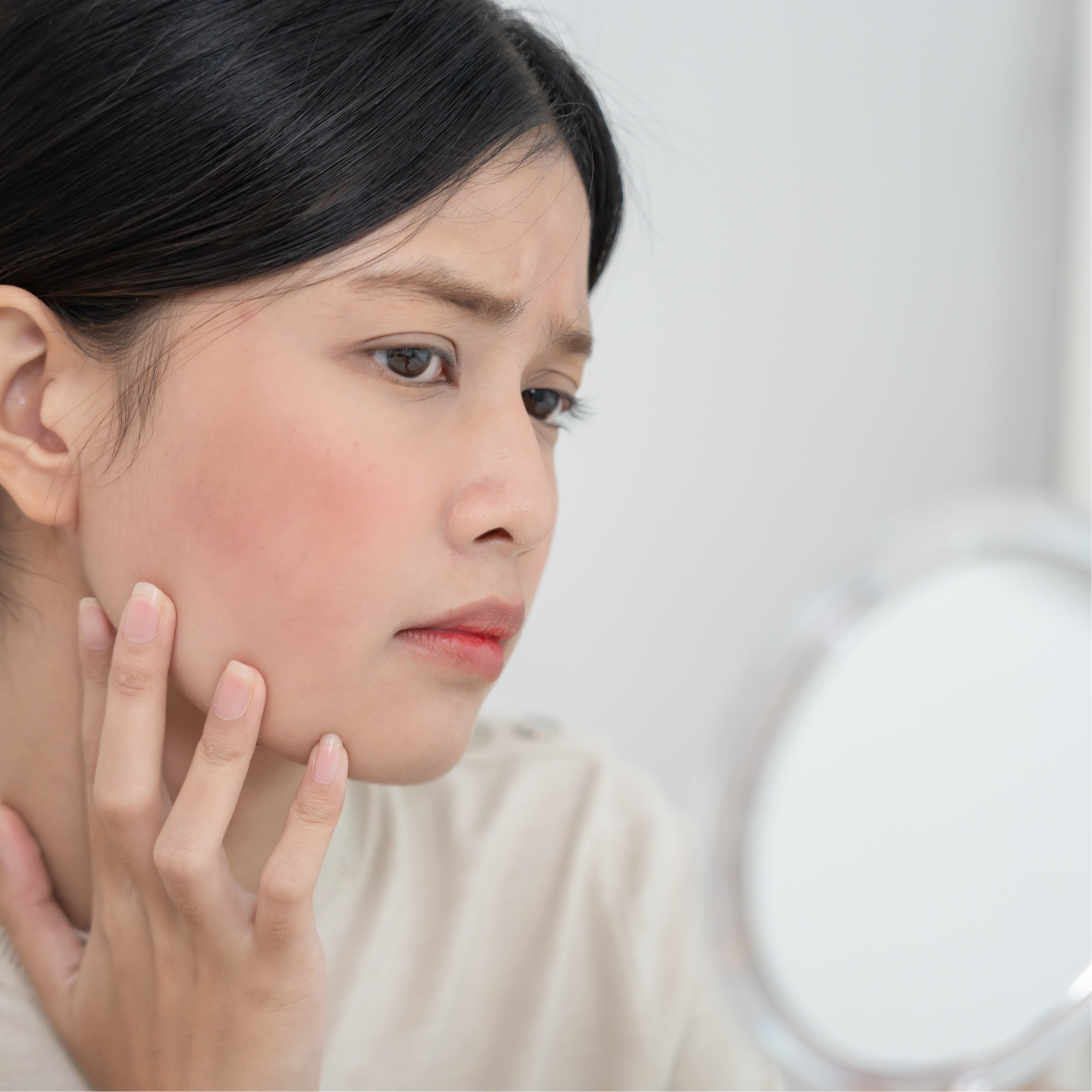 Mesoterapia Facial Piel con Enrojecimiento — Clínica NÜM