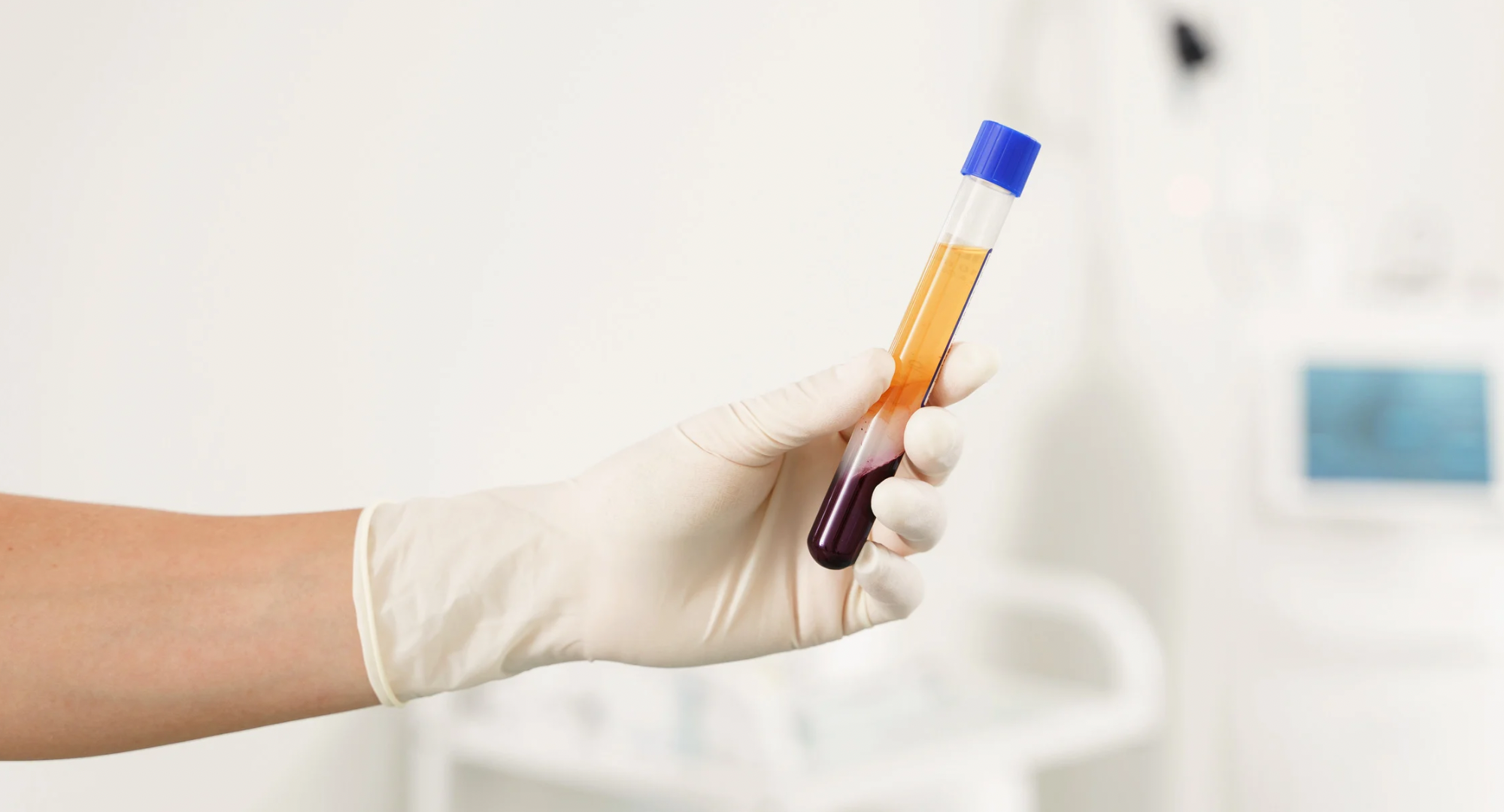 Poder de Factores de Crecimiento del Plasma Rico en Plaquetas