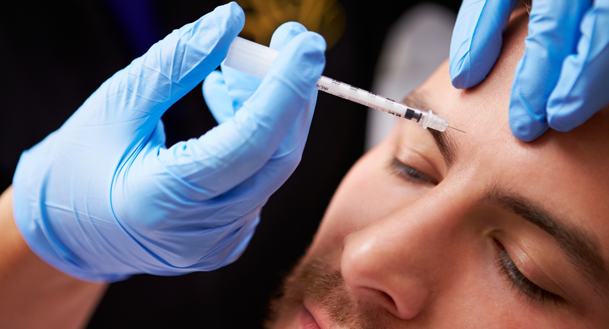 ¿Qué es Bótox? Todo lo que necesitas saber