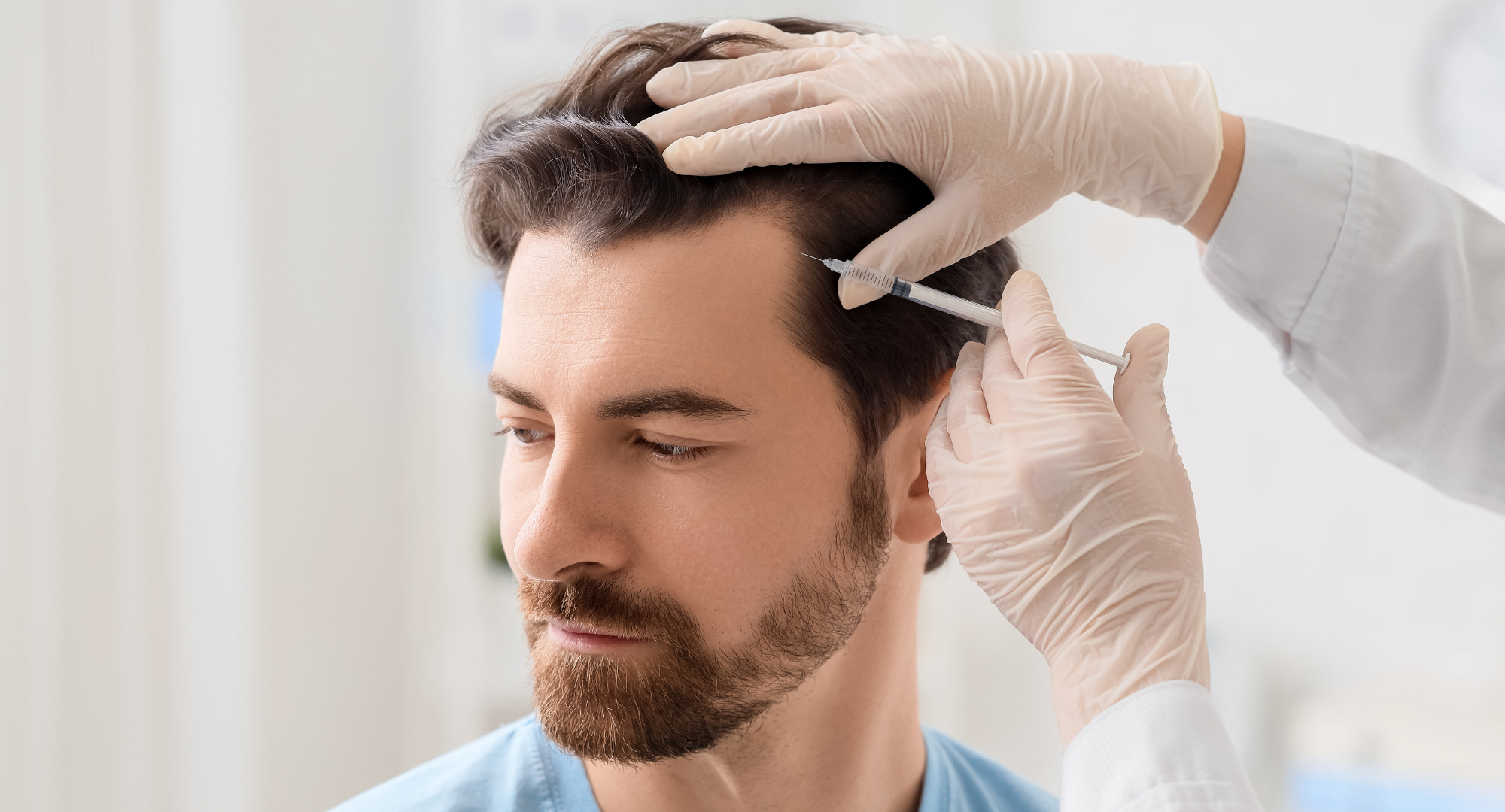 ¿Qué es mesoterapia capilar? El tratamiento que revitaliza tu cabello desde la raíz