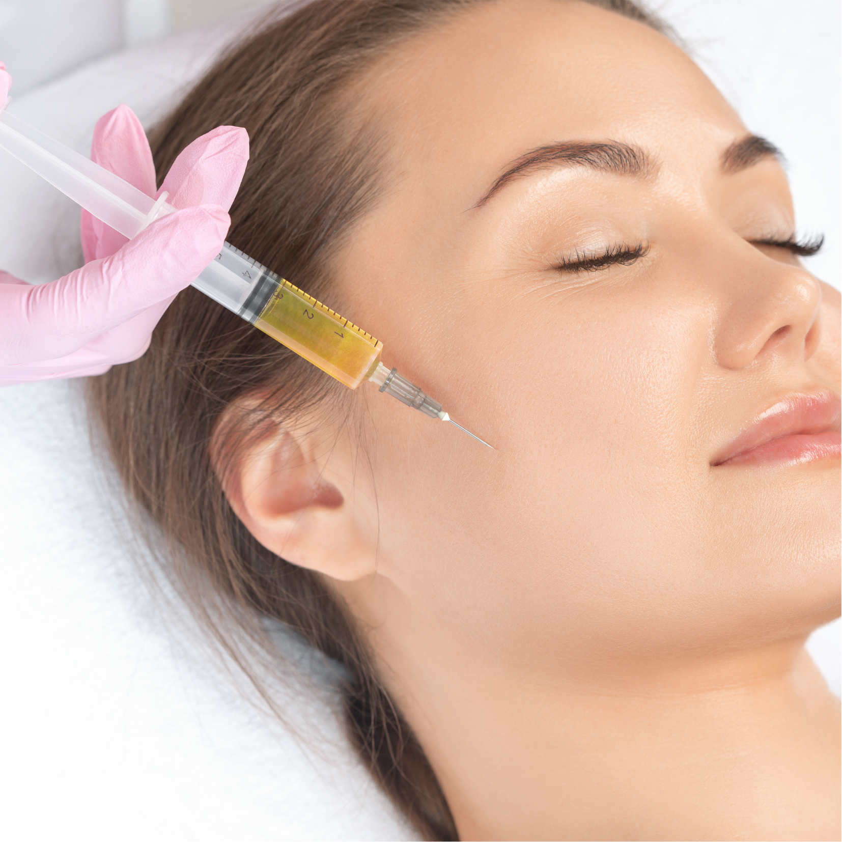 Rejuvenecimiento Facial PRP