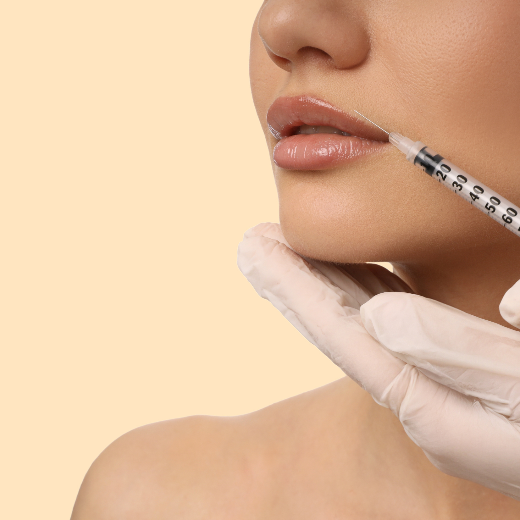 Relleno de Labios — Clínica NÜM