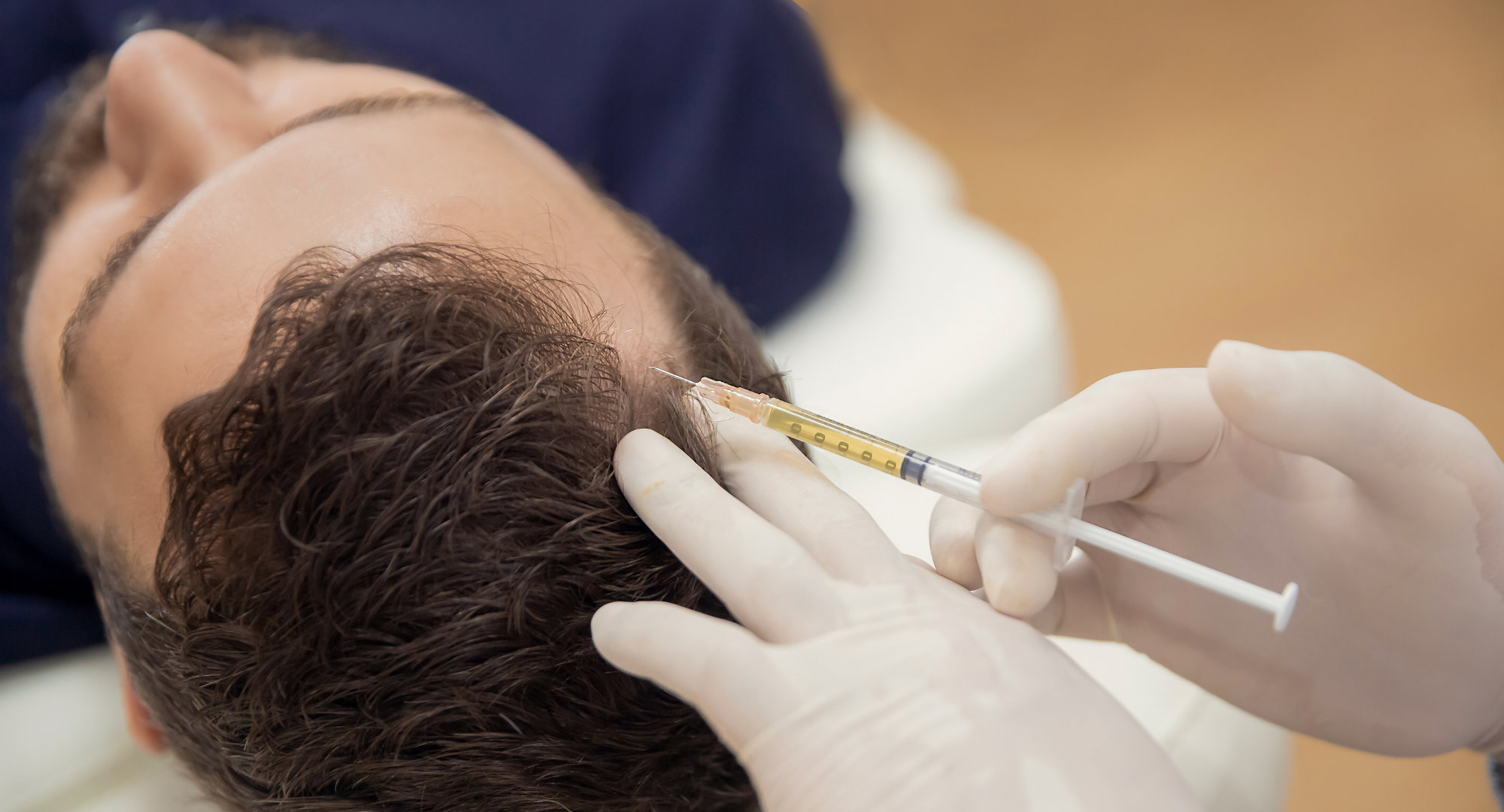 Terapia Capilar con PRP