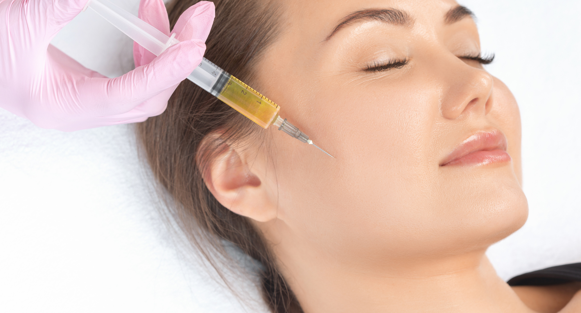 Rejuvenecimiento Facial con PRP