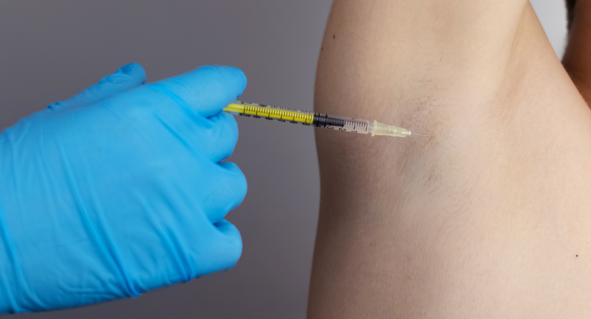 Toxina Botulínica para Hiperhidrosis