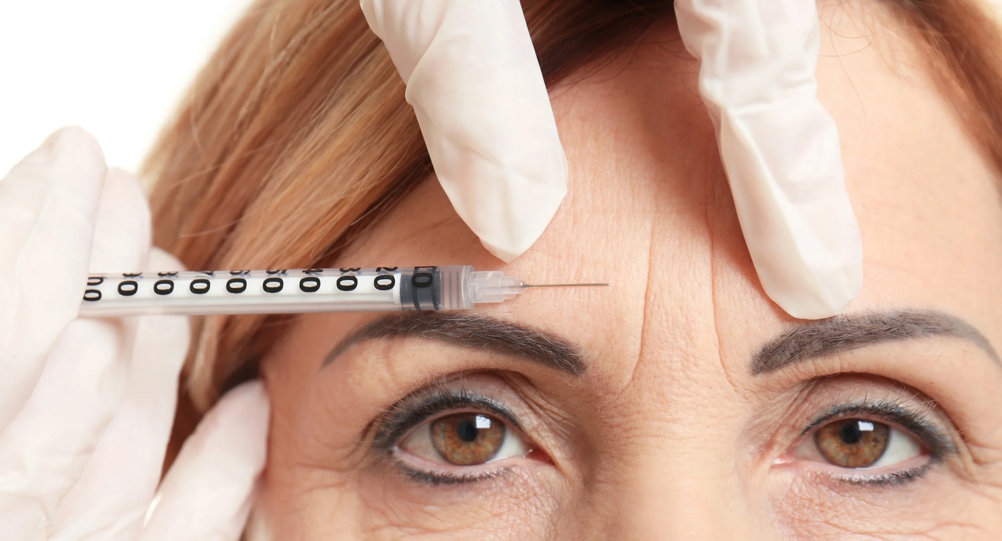 Tratamiento para las arrugas: opciones efectivas para rejuvenecer el rostro