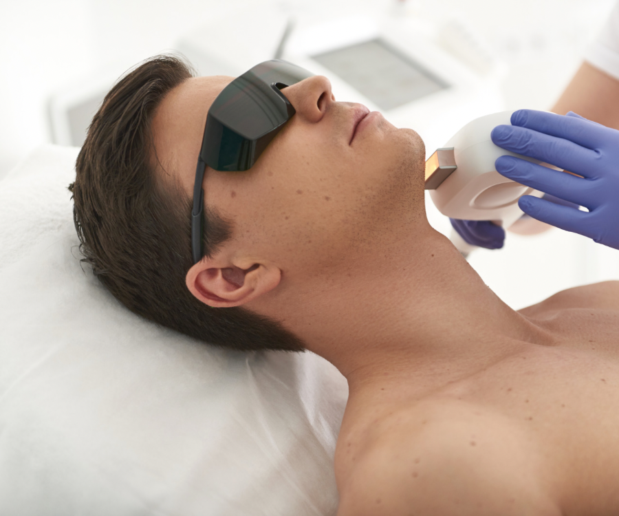 Depilación Láser Masculina — Rostro y Cuello