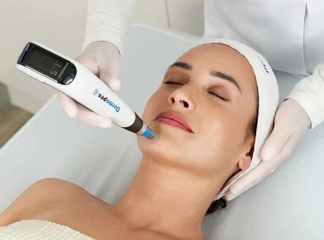 Mesoterapia + Dermapen4™